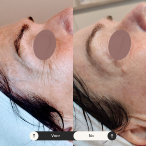 Beige Minimalist Skincare Before and After Instagram Post (4) Beige Minimalist Skincare Before and After Instagram Post (4)