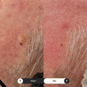 Beige Minimalist Skincare Before and After Instagram Post (5) Beige Minimalist Skincare Before and After Instagram Post (5)