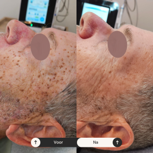 Beige Minimalist Skincare Before and After Instagram Post (6) Beige Minimalist Skincare Before and After Instagram Post (6)