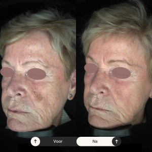 Beige Minimalist Skincare Before and After Instagram Post (7) Beige Minimalist Skincare Before and After Instagram Post (7)