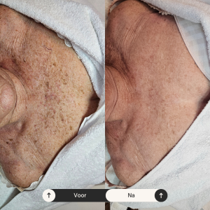 Beige Minimalist Skincare Before and After Instagram Post (8) Beige Minimalist Skincare Before and After Instagram Post (8)