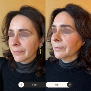 Beige Minimalist Skincare Before and After Instagram Post (9) Beige Minimalist Skincare Before and After Instagram Post (9)